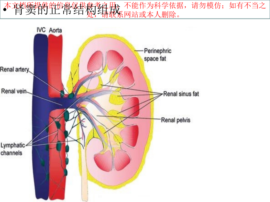 肾窦病变的影像诊疗培训课件.ppt_第2页