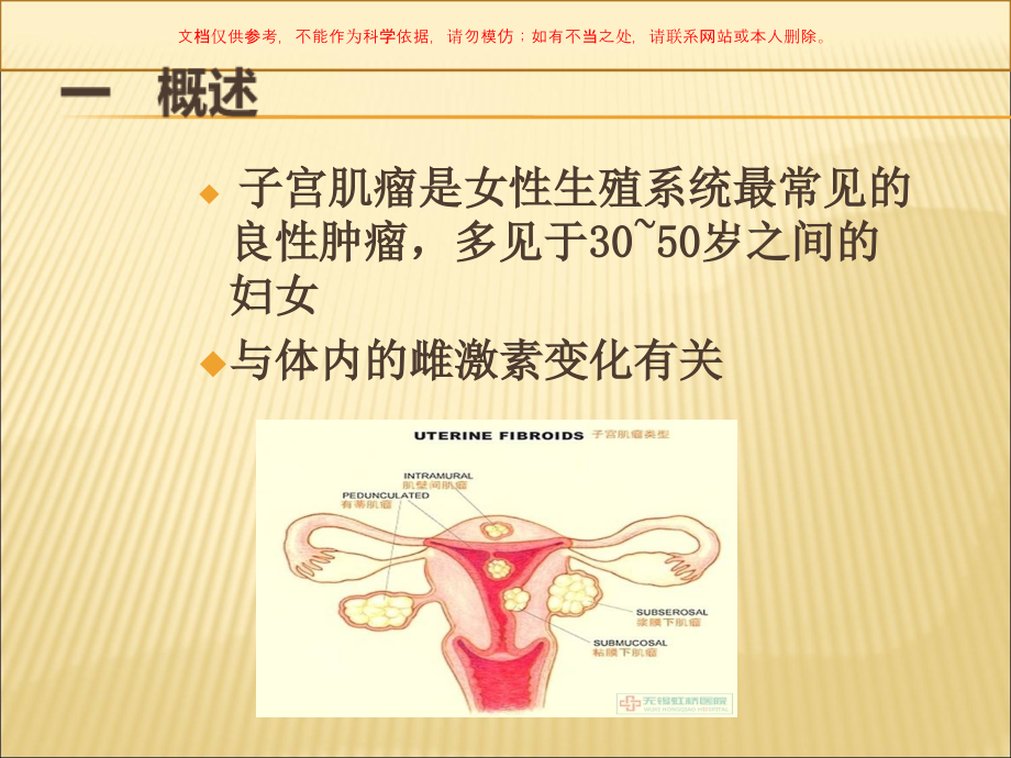 子宫肌瘤和妇科腹部病人的护理培训课件.ppt_第1页