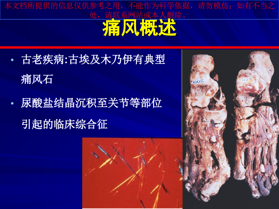 痛风指南解读和诊治进展培训课件.ppt_第1页