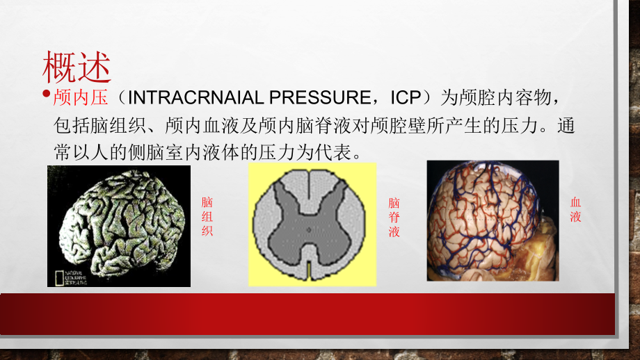 颅内高压危象课件.pptx_第2页