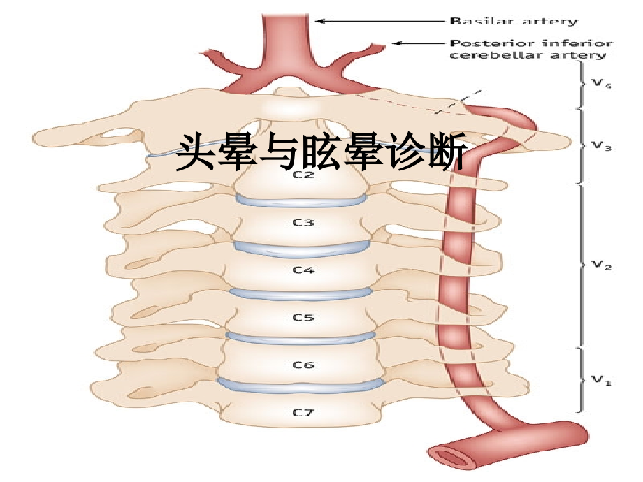 头晕与眩晕诊断.ppt_第1页