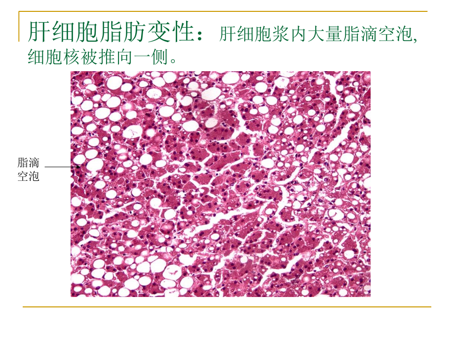 病理学实验切片考试图讲义.ppt_第2页