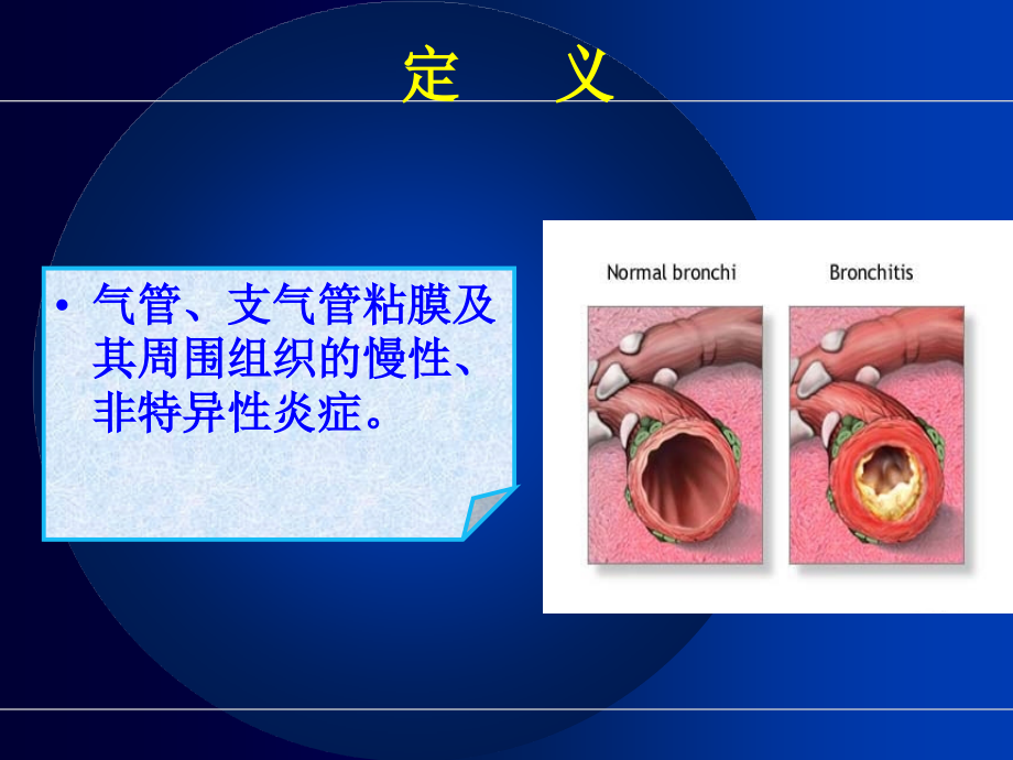慢性支气管炎病人的护理.ppt_第2页