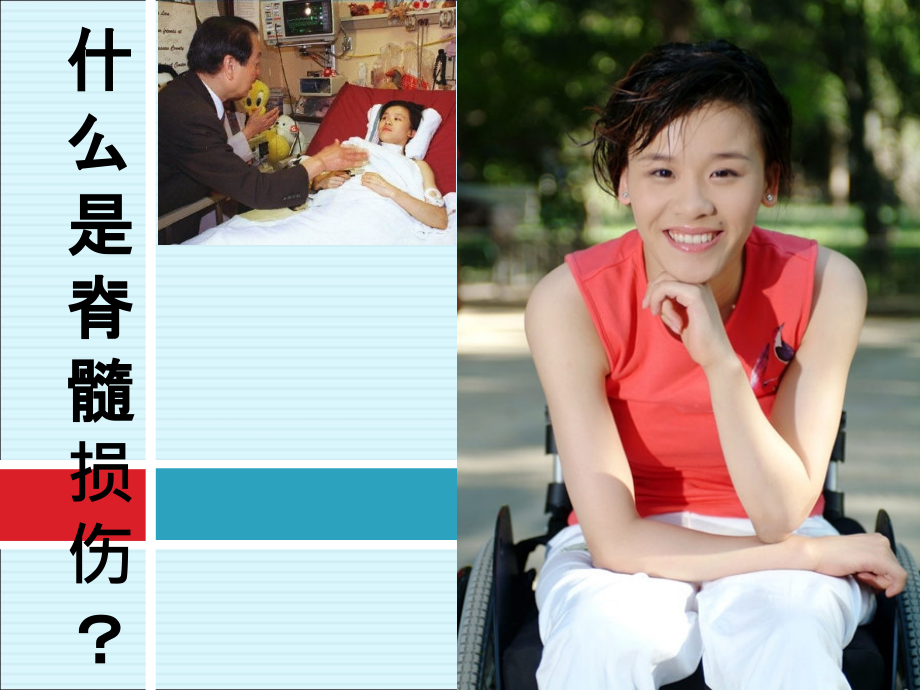 脊髓损伤概述PPT优质课件.ppt_第2页