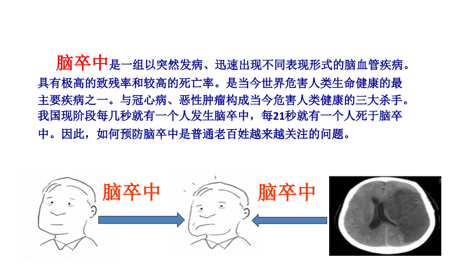 医学脑卒中趣味专题知识讲座课件.ppt_第2页