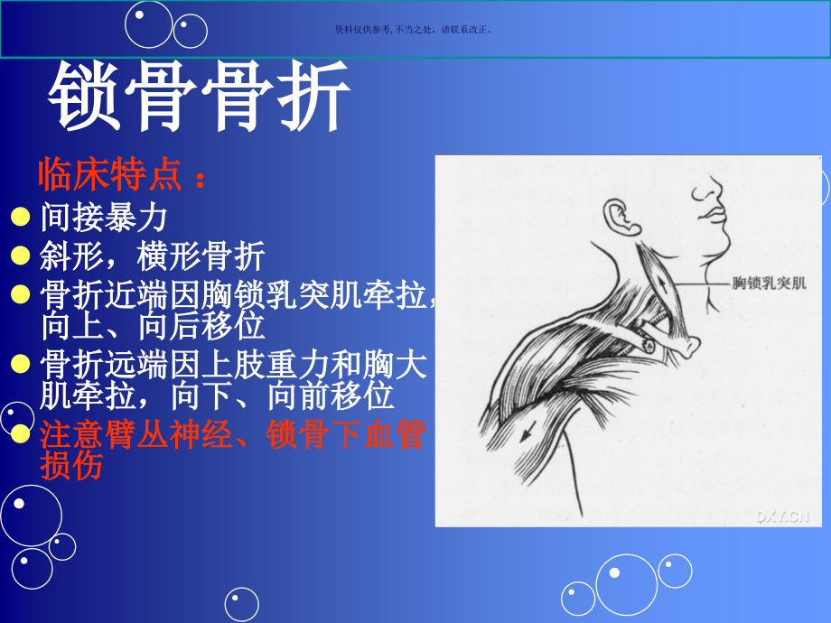 四肢骨折和护理.ppt_第2页