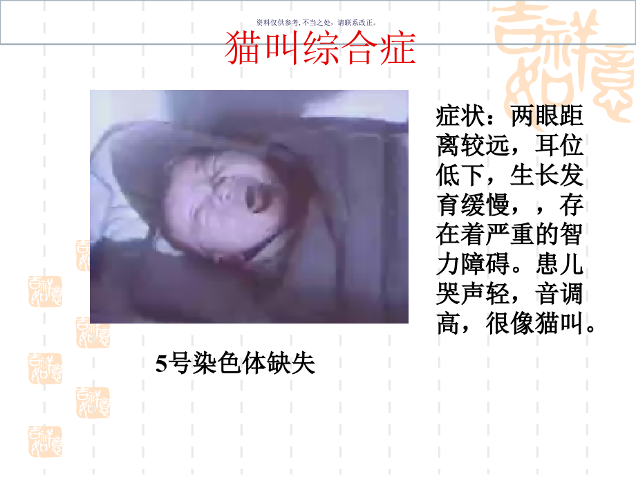 染色体畸变主题医学知识.ppt_第2页