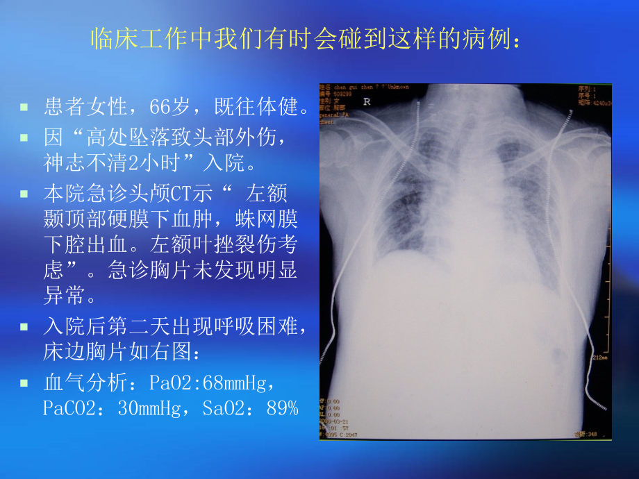 顽固性低氧血症的诊断与治疗.ppt_第1页