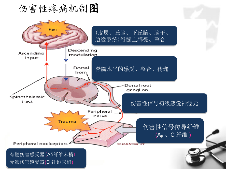 阿片受体的功能差异与镇痛药的选择-医学课件.ppt_第1页