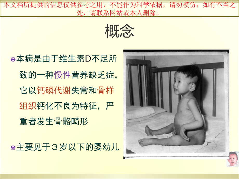 维生素D缺乏性佝偻病小讲课培训课件.ppt_第1页