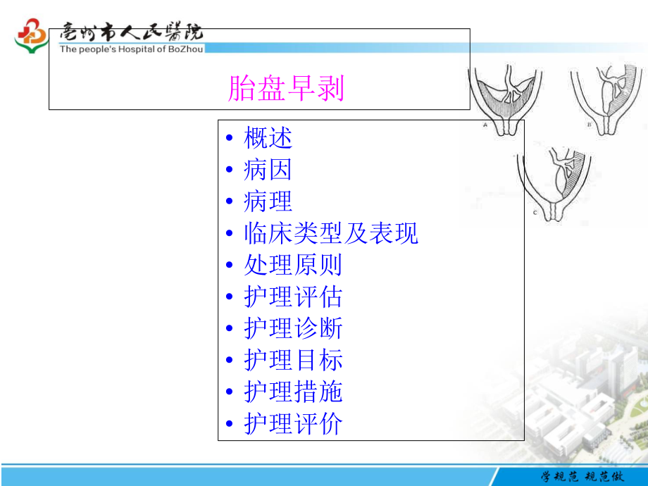 胎盘早剥护理专题宣讲-医学课件.ppt_第1页