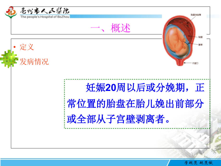 胎盘早剥护理专题宣讲-医学课件.ppt_第2页