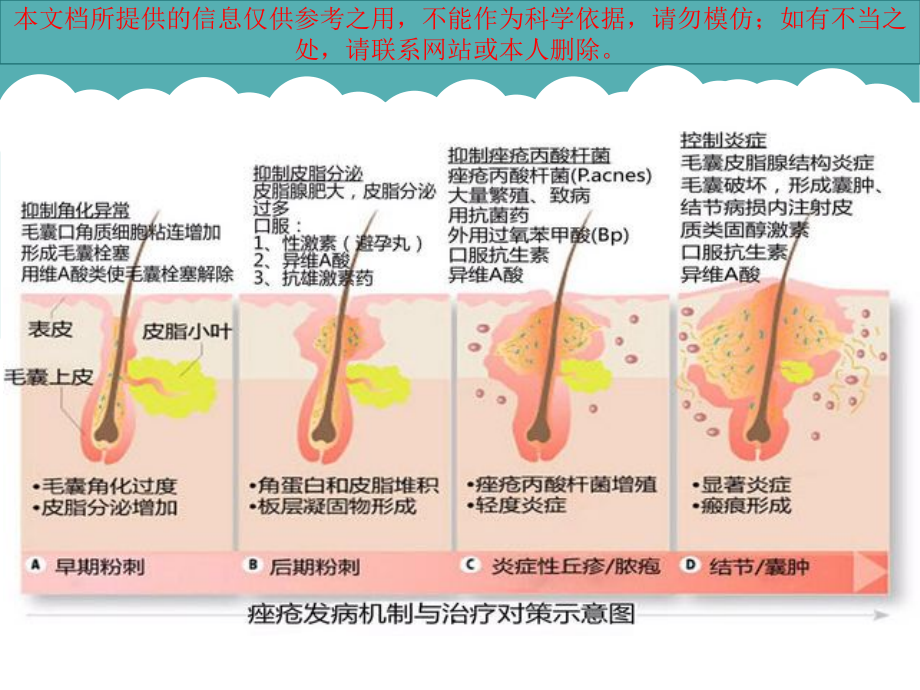 痤疮指南对比培训课件.ppt_第2页