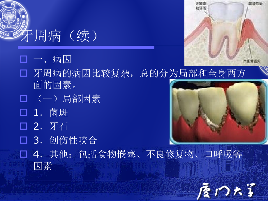 预防口腔医学第八、九章牙周与粘膜病.ppt_第1页