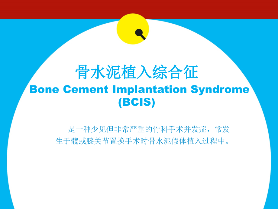 医学骨水泥植入综合症专题课件.ppt_第2页