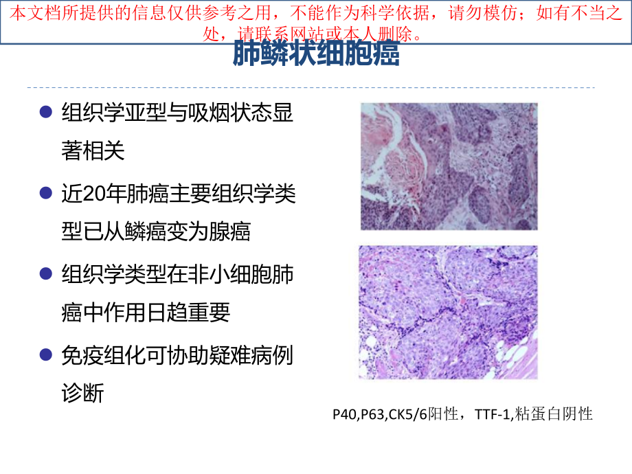 肺鳞癌个体化治疗现状和前景培训课件.ppt_第2页