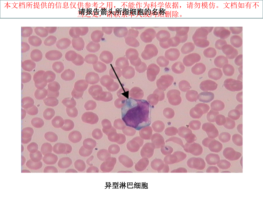 血涂片图谱专题知识宣讲培训课件.ppt_第2页