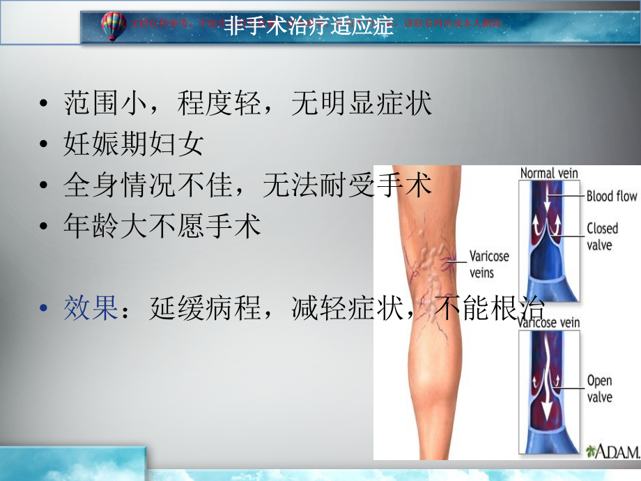 原发性静脉曲张的治疗与护理培训课件.ppt_第2页