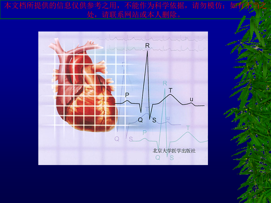 临床心电图专业知识讲座培训课件.ppt_第1页
