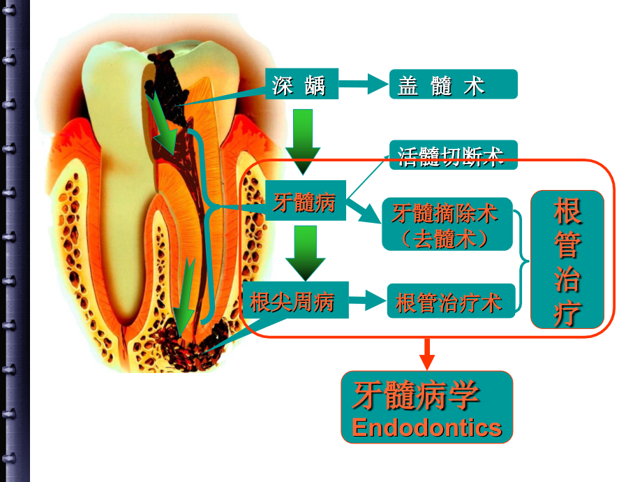 医学根管治疗的步骤方法器械PPT培训课件.ppt_第2页
