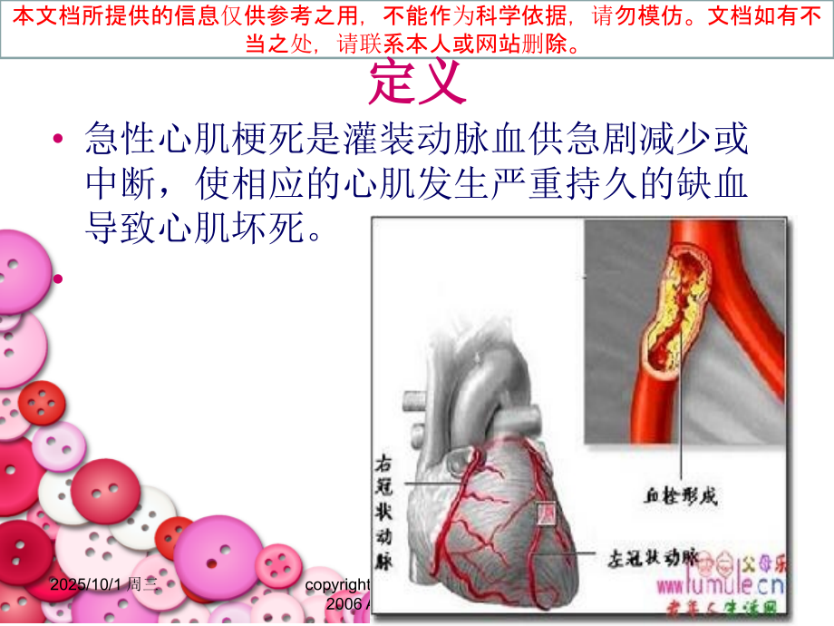 急性心肌梗死病人的护理培训课件.ppt_第2页