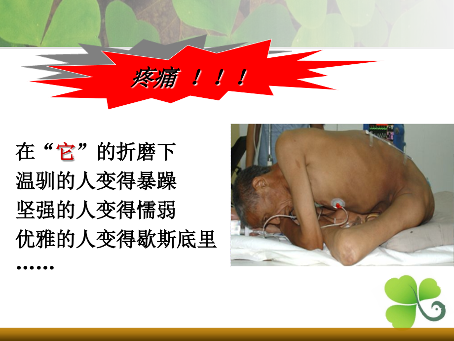 癌症疼痛的医疗护理PPT培训课件.ppt_第2页