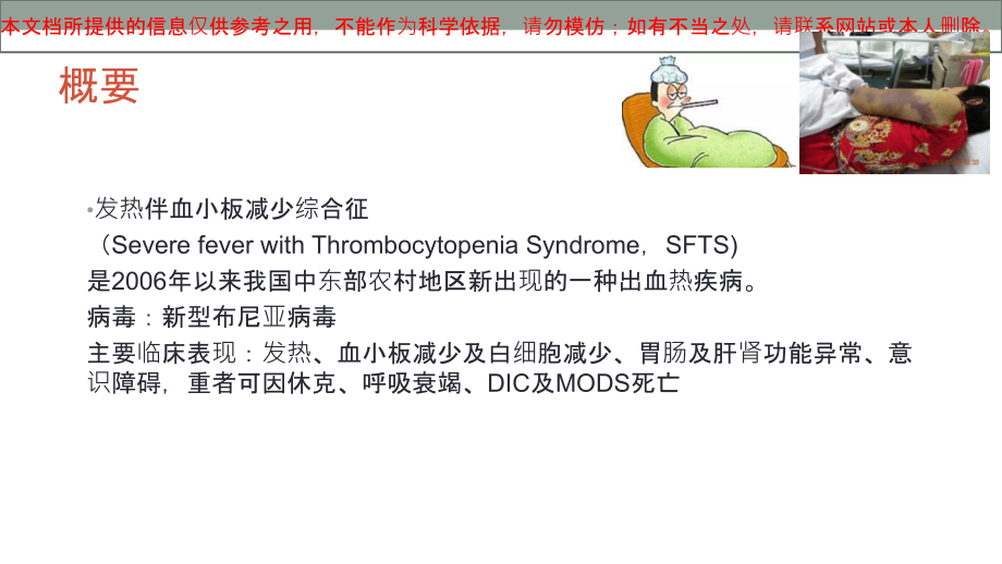 发热伴血小板减少和鉴别诊疗培训课件.ppt_第1页