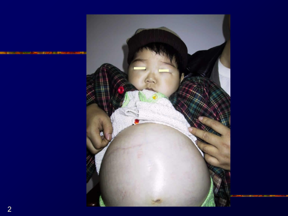 重庆医科大学《临床医学概论》之肾病教学.ppt_第2页