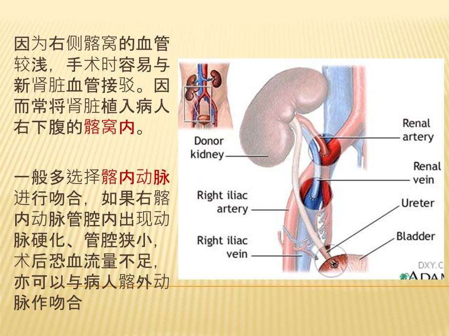 肾移植彩图.ppt_第2页