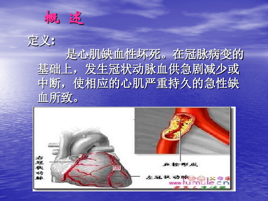心梗9.12.ppt_第2页
