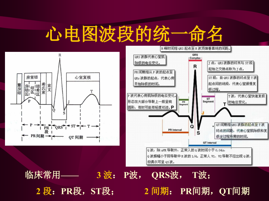 心电图心电向量与心肌缺血.ppt_第1页