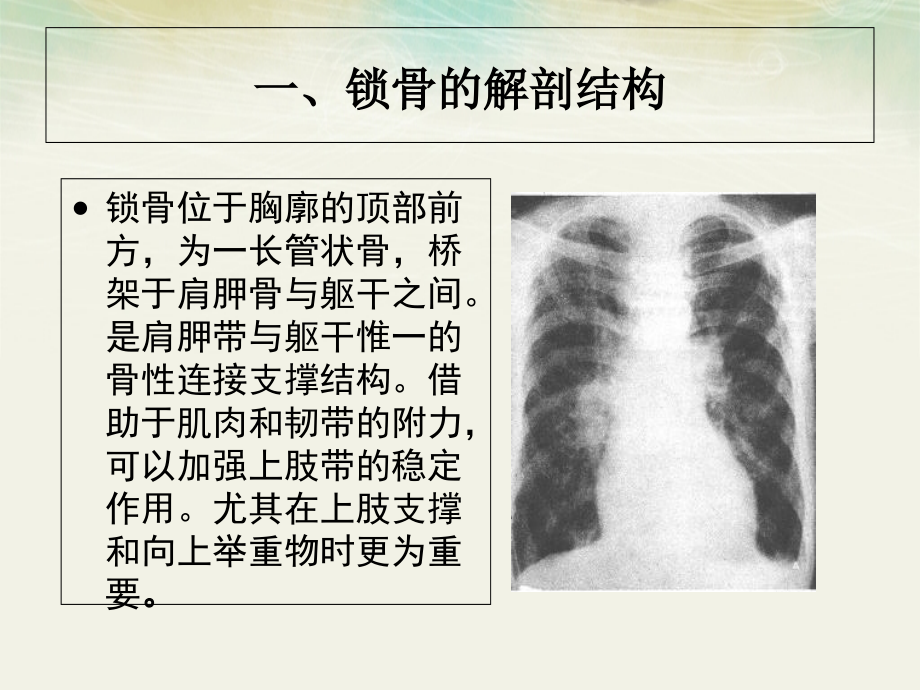 锁骨骨折病人护理龚婕.ppt_第1页
