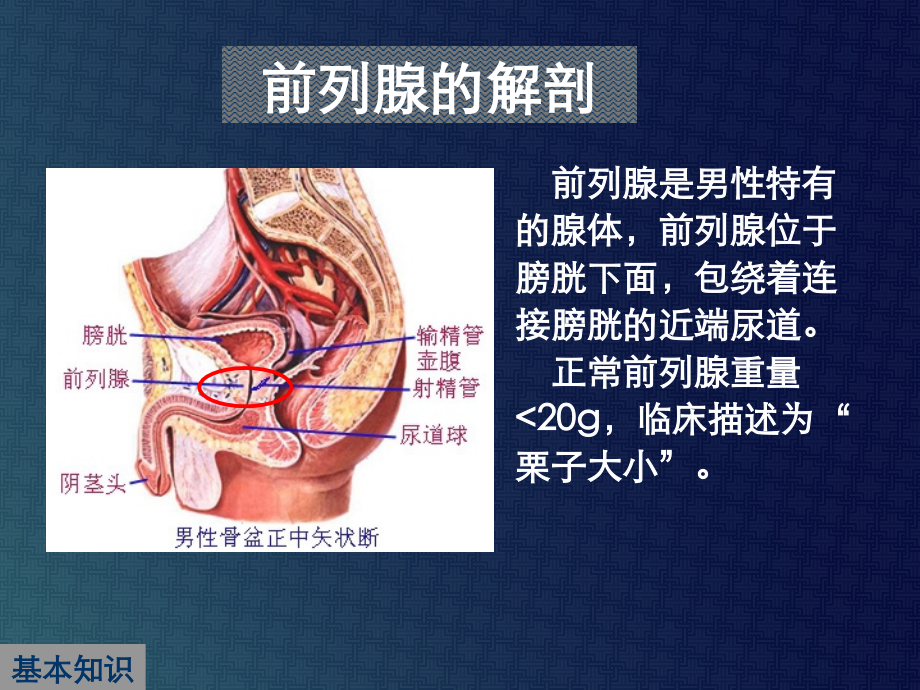 解读《中国良性前列腺增生症防治指南》.ppt_第2页