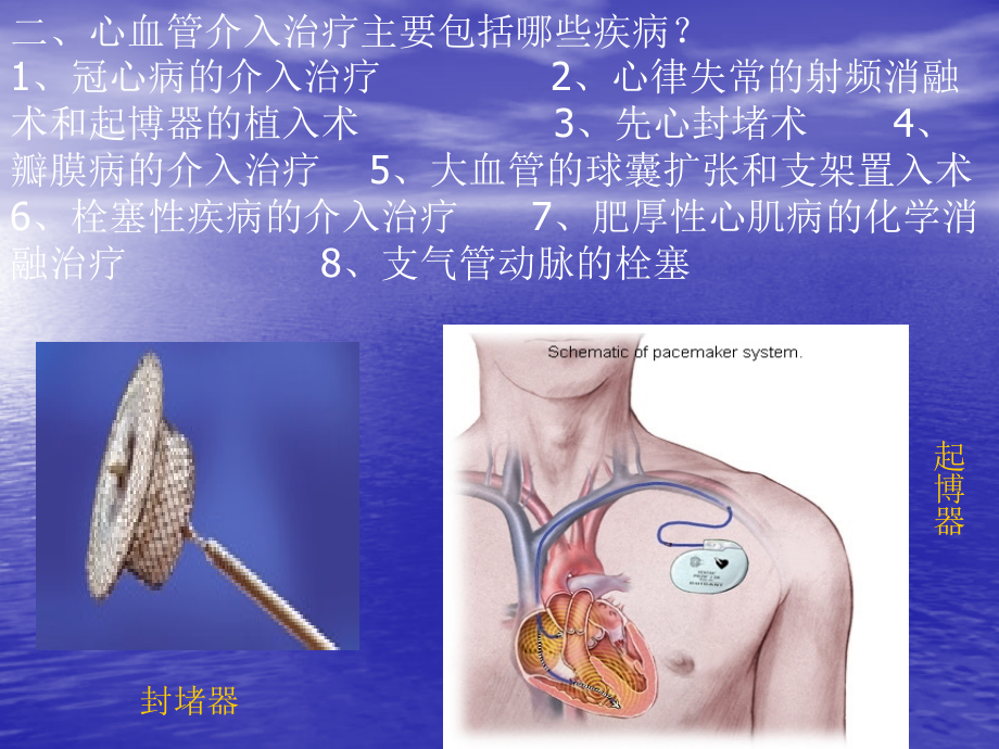 心血管介入手术病人的护理.ppt_第2页