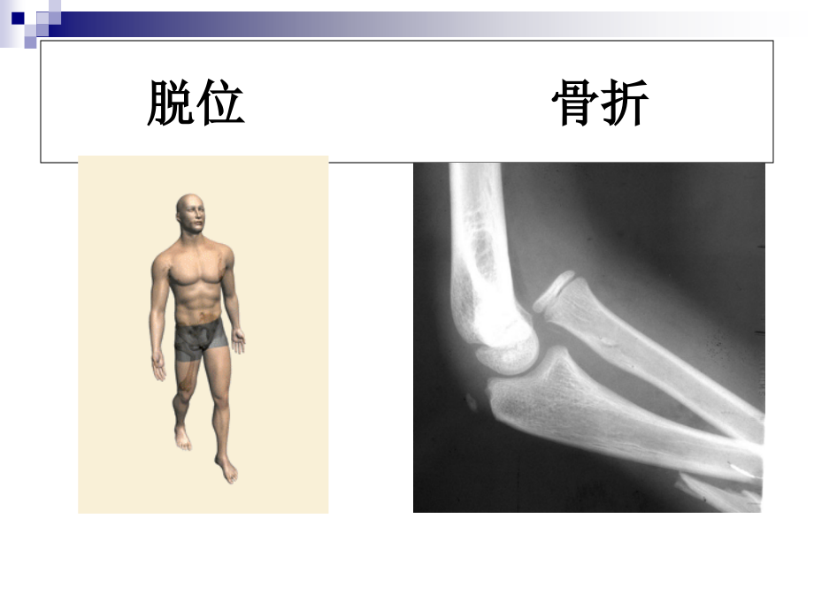 跌倒的有效管理.ppt_第2页