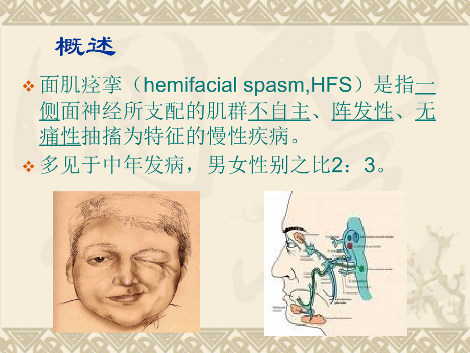 面积痉挛围手术期护理.ppt_第1页