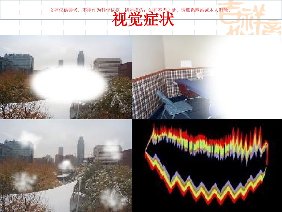 偏头痛医学知识讲座培训课件.ppt_第2页