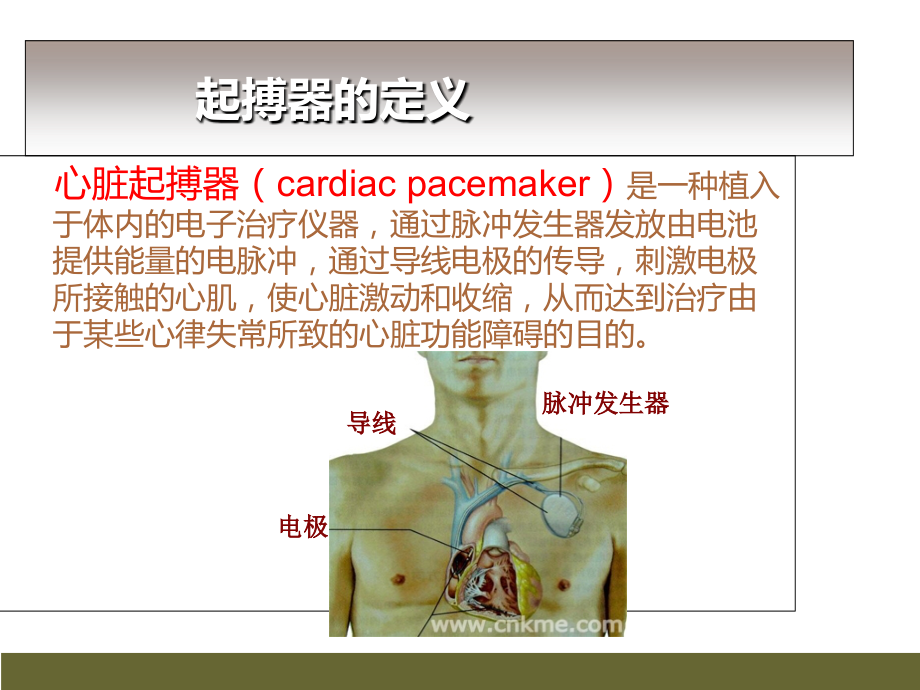 起搏器(1)(1).ppt_第2页