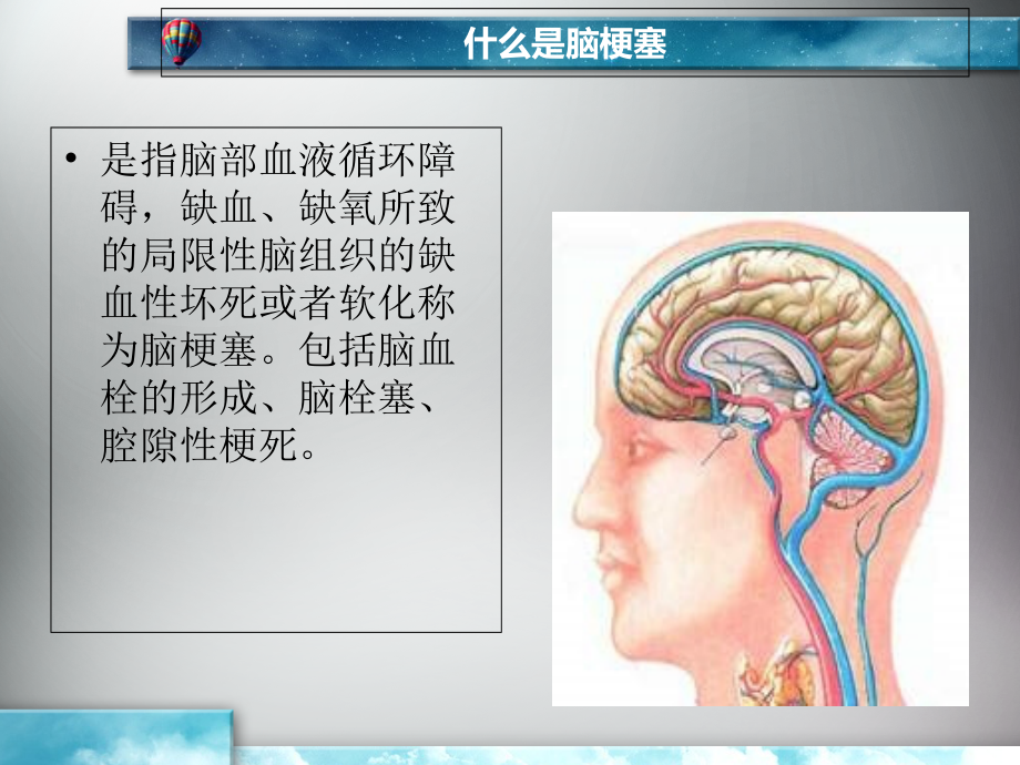 脑梗塞的护理查房2.ppt_第1页