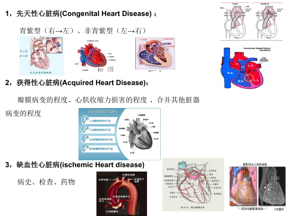 心脏病人的麻醉优质PPT课件.ppt_第2页