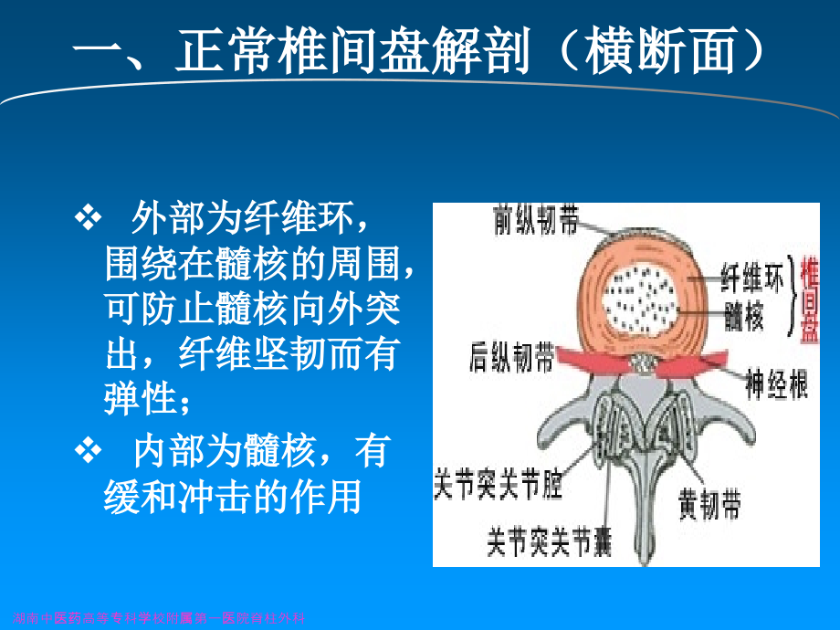 腰椎间盘突出症术(骨三科教学查房汤湘江).ppt_第2页