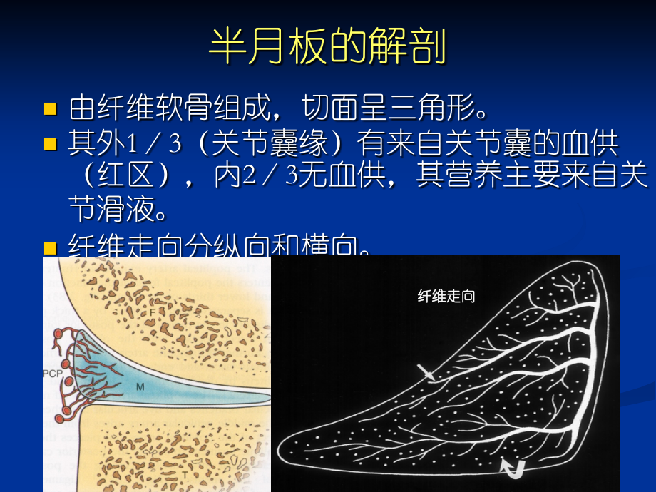 半月板撕裂的MR诊疗优质PPT课件.ppt_第2页