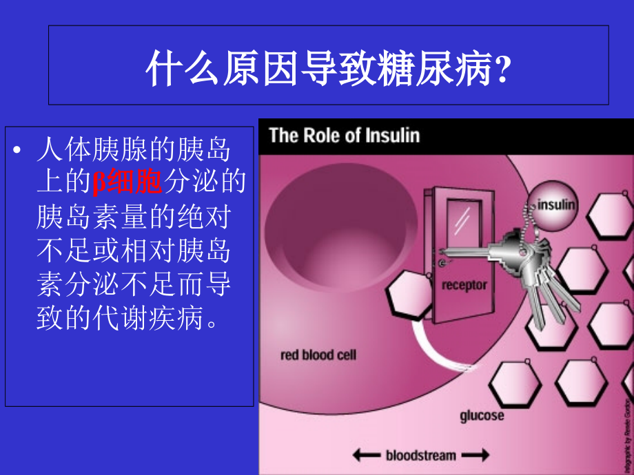糖尿病李.ppt_第2页