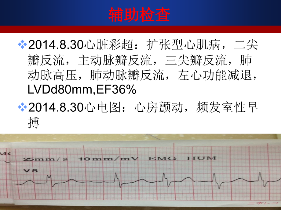 心肌病护理ok.ppt_第2页