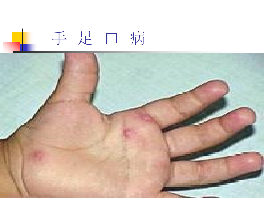 船营区春季传染病防治知识.ppt_第1页