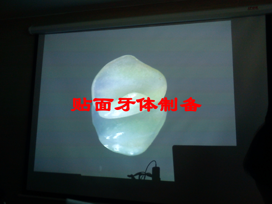 贴面牙体制备课件.ppt_第1页