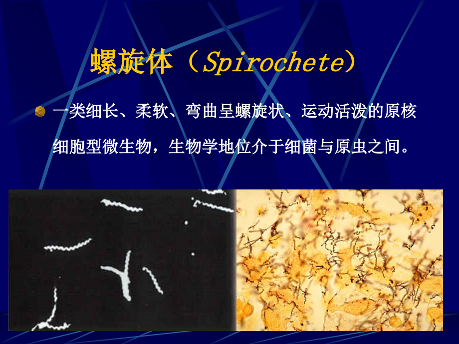 螺旋体和支原体.ppt_第2页