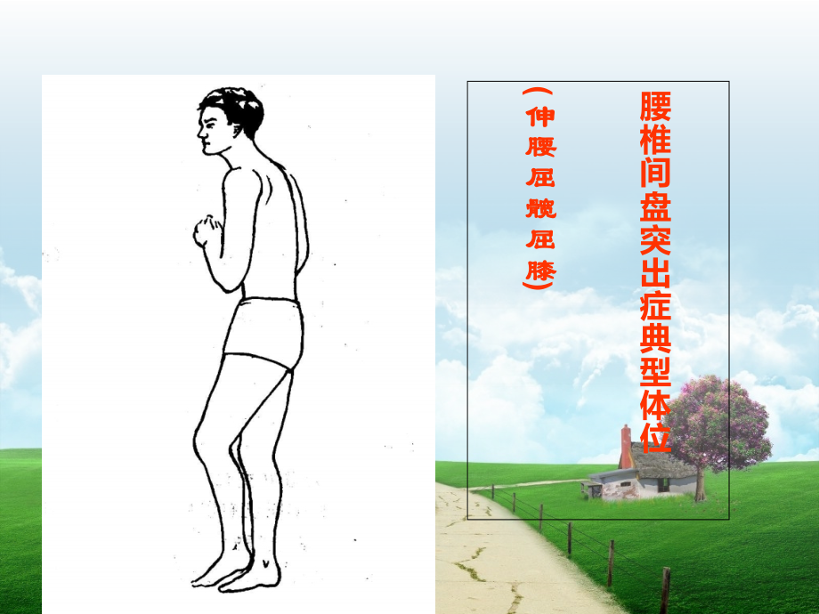 腰椎查体演稿.ppt_第2页