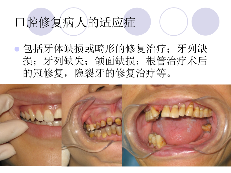 口腔修复病人的基础护理.ppt_第1页