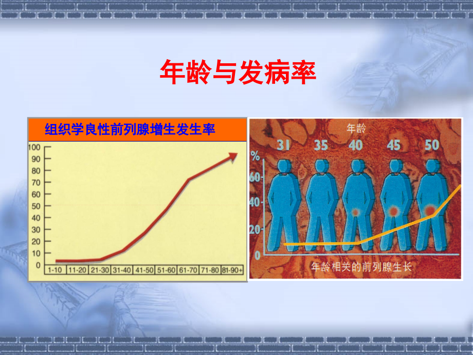 良性前列腺增生症的中西医诊治.ppt_第2页
